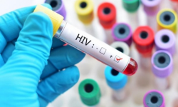 Thế nào là HIV dương tính?