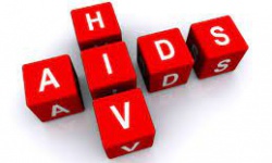 Người phạm tội nhiễm HIV có được đặc xá không?