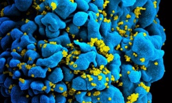 Hai bệnh nhân tự ức chế virus HIV sau khi ngừng dùng thuốc điều trị