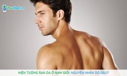 Hiện tượng rạn da ở nam giới: nguyên nhân do đâu?