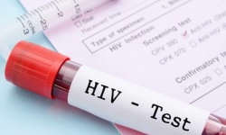 Xét nghiệm HIV âm tính là gì?