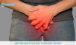 Có hay không bệnh viêm niệu đạo ở nam giới?