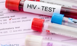 Xét nghiệm HIV